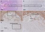 GFAP Antibody in Immunohistochemistry (IHC)