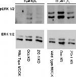 ERK1/ERK2 Antibody in Western Blot (WB)