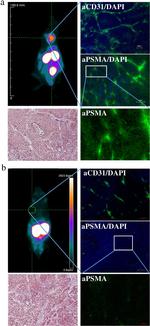 CD31 Antibody in Immunohistochemistry (IHC)