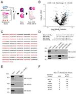 ACADVL Antibody in Western Blot (WB)