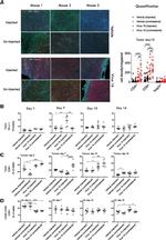 FOXP3 Antibody in Immunohistochemistry (IHC)