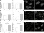 Nesprin 1 Antibody in Immunocytochemistry (ICC/IF)