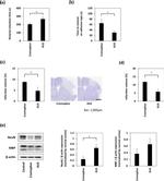 MBP Antibody in Western Blot (WB)