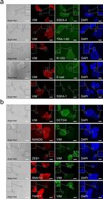 E-cadherin Antibody in Immunocytochemistry, Immunohistochemistry (ICC/IF, IHC)