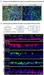 FOXJ1 Antibody in Immunocytochemistry (ICC/IF)