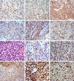 SEL1L Antibody in Immunohistochemistry (IHC)