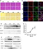 HIF1A Antibody in Immunocytochemistry (ICC/IF)