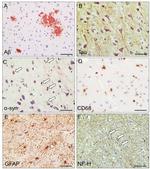 CD68 Antibody in Immunohistochemistry (IHC)