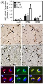 HAS2 Antibody in Immunohistochemistry (IHC)