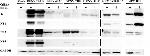 Dengue Virus Type 2 NS5 Antibody in Western Blot (WB)