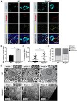 CD105 Antibody in Immunohistochemistry (IHC)