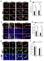 Ki-67 Antibody in Immunohistochemistry (IHC)