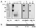 Penta-His Tag Antibody in Western Blot (WB)