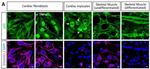 Vimentin Antibody in Immunocytochemistry (ICC/IF)