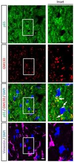 Vimentin Antibody in Immunohistochemistry (IHC)