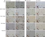 Fibronectin Antibody in Immunohistochemistry (IHC)