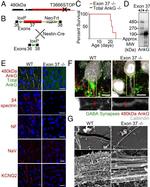 KCNQ2 Antibody in Immunohistochemistry (Paraffin) (IHC (P))