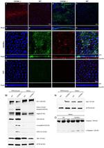 beta Amyloid Antibody in Western Blot, Immunohistochemistry (WB, IHC)