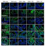 Claudin 1 Antibody in Immunohistochemistry (IHC)