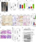 N-cadherin Antibody in Immunohistochemistry (IHC)