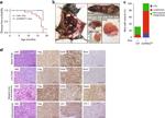 CD20 Antibody in Immunohistochemistry (IHC)