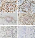 SOX2 Antibody in Immunohistochemistry (IHC)