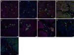 SOX2 Antibody in Immunohistochemistry (IHC)