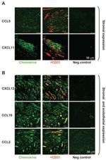 CD31 Antibody in Immunohistochemistry (IHC)