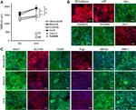 INSR beta Antibody in Immunocytochemistry (ICC/IF)