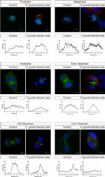 Toxoplasma gondii Antibody in Immunocytochemistry (ICC/IF)