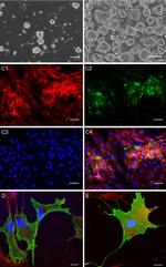 SSEA3 Antibody in Immunocytochemistry (ICC/IF)