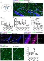 Ki-67 Antibody in Immunohistochemistry (IHC)