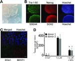 EEA1 Antibody in Immunocytochemistry (ICC/IF)