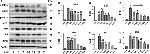 Phospho-IRE1 alpha (Ser724) Antibody in Western Blot (WB)