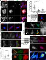 EB1 Antibody in Immunocytochemistry (ICC/IF)