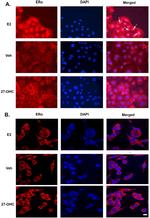 Estrogen Receptor alpha Antibody in Immunocytochemistry (ICC/IF)