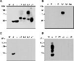 Dengue Virus Type 2 NS1 Antibody in Western Blot (WB)