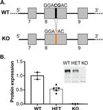 SynGAP Antibody in Western Blot (WB)