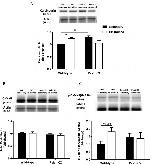 Calcineurin A Antibody in Western Blot (WB)