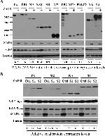 ZC3HAV1 Antibody in Western Blot (WB)