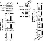 beta Amyloid Antibody in Western Blot (WB)