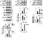 beta Amyloid Antibody in Western Blot (WB)