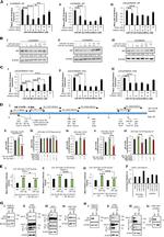 Androgen Receptor Antibody in Western Blot (WB)