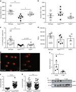 TOP2B Antibody in Western Blot (WB)