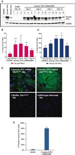 OTC Antibody in Immunocytochemistry, Immunohistochemistry (ICC/IF, IHC)