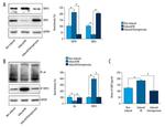 TRPV1 Antibody in Western Blot (WB)