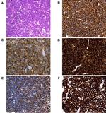 OLIG1 Antibody in Immunocytochemistry (ICC/IF)