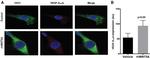 CD31 Antibody in Immunohistochemistry (IHC)