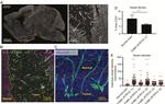 Claudin 5 Antibody in Immunohistochemistry (IHC)