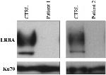 Ku70 Antibody in Western Blot (WB)